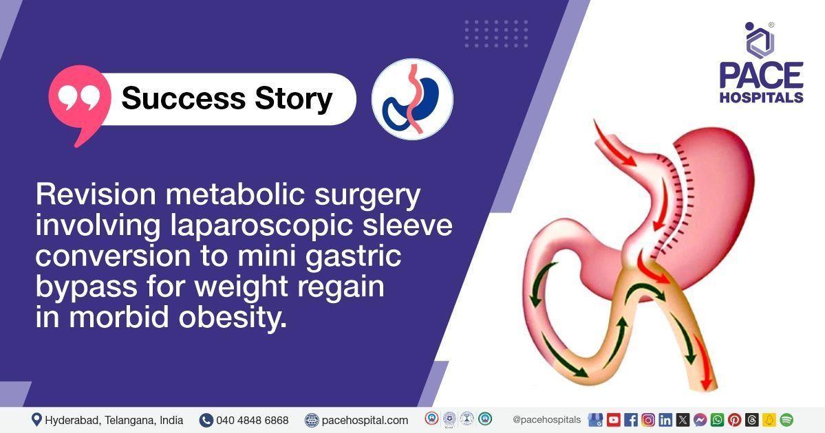 Case study of Morbid Obesity Treated with Mini Gastric Bypass Procedure at PACE Hospitals
