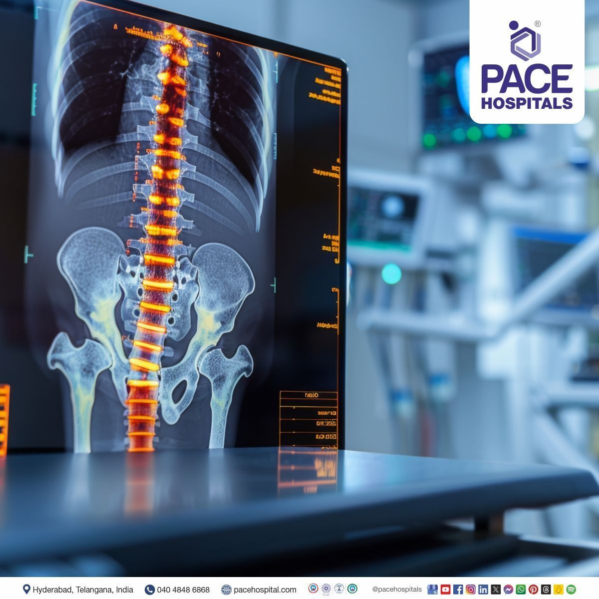 Orthopaedic diagnosis in Hyderabad |  shoulder orthopedic tests | orthopedic examination | knee orthopedic tests | orthopedic surgery | orthopedic procedure in India