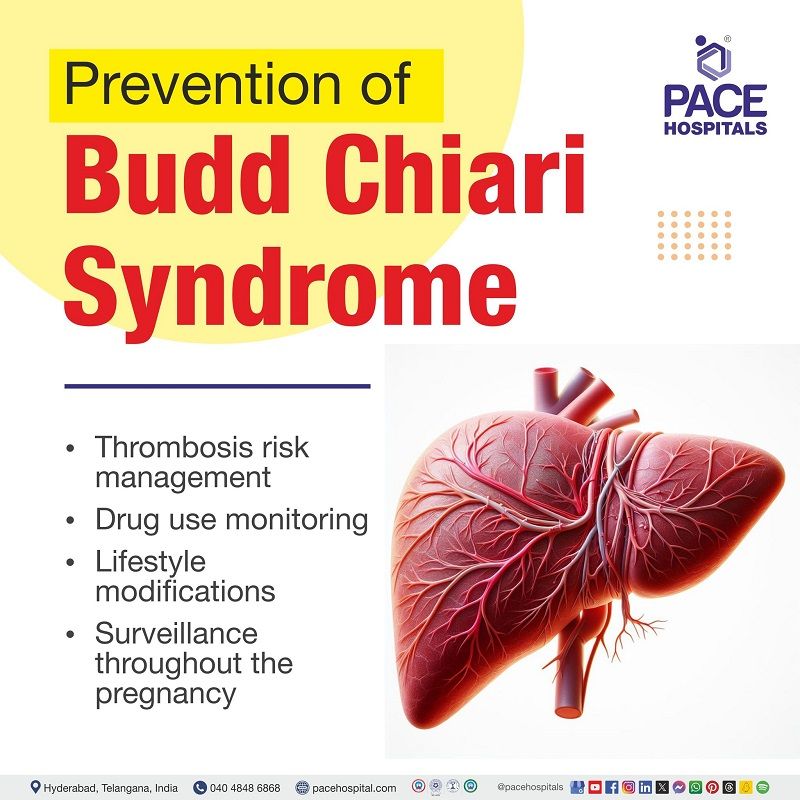 Budd-Chiari syndrome preventive measures | Prevention of Budd Chiari syndrome | Preventive measures of Budd-Chiari syndrome | Visual outlining preventive measures of Budd-Chiari syndrome