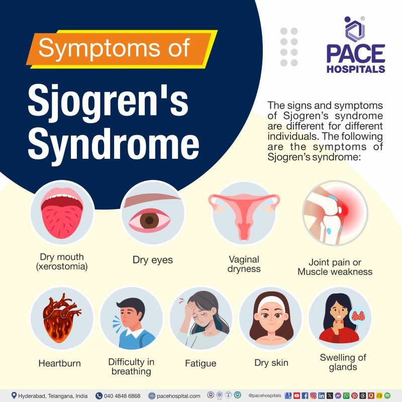 Sjogren's Syndrome Symptoms Sjogren's syndrome symptoms | Symptoms of sjogren's syndrome | Symptoms sjogren's syndrome