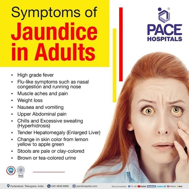 Jaundice Disease - Symptoms, Causes, Complications and Prevention