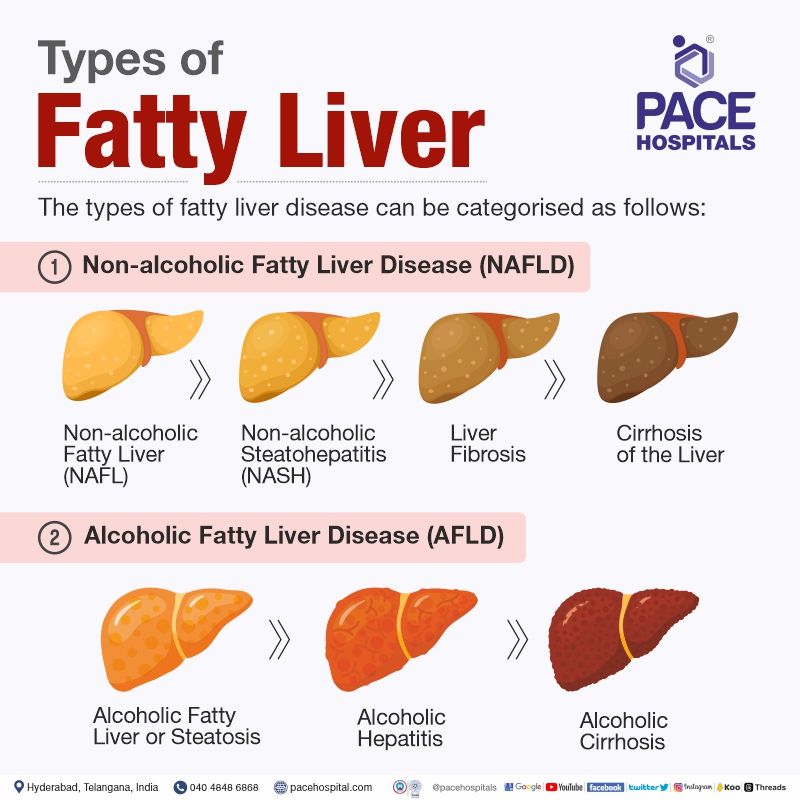 types of fatty liver disease | fatty liver types | fatty liver treatment in hyderabad telangana india