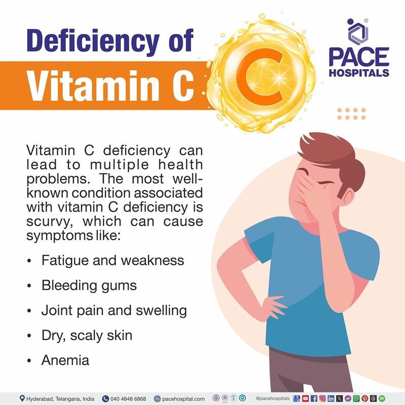 vitamin c deficiency | vitamin c deficiency symptoms | deficiency of vitamin c causes | vitamin c deficiency leads to