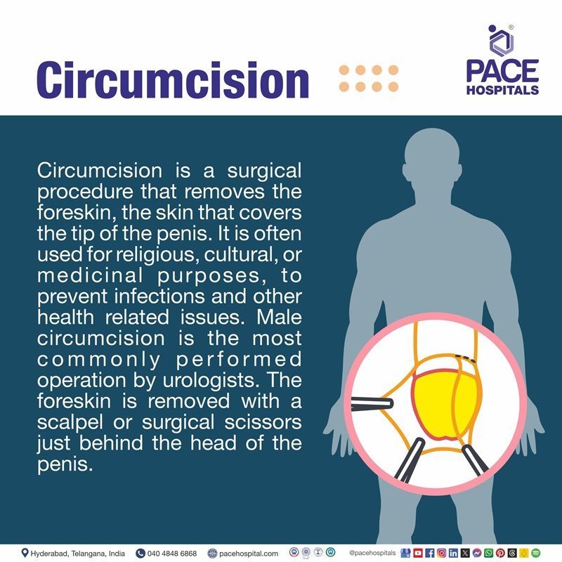 best circumcision hospitals in Hyderabad | circumcision cost in Hyderabad | painless male circumcision Hyderabad | circumcision laser surgery cost in Hyderabad India