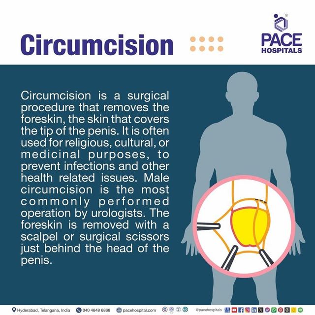 Types Of Male Circumcision Types Of Male Circumcision