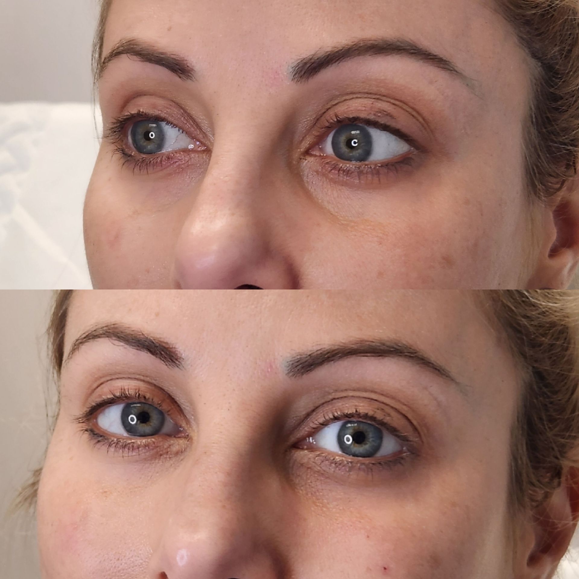 A before and after picture of a woman 's eyes