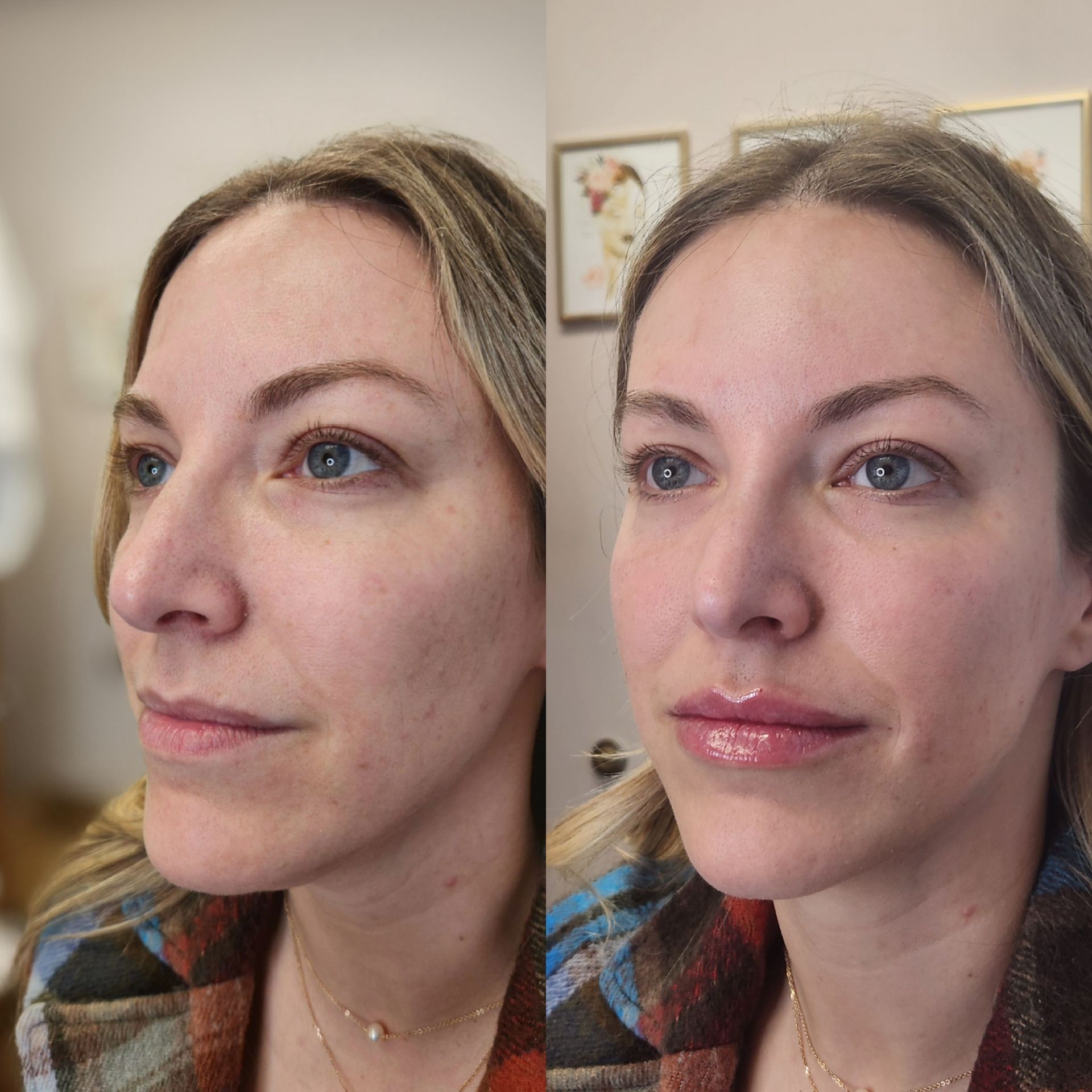 A before and after photo of a woman 's face
