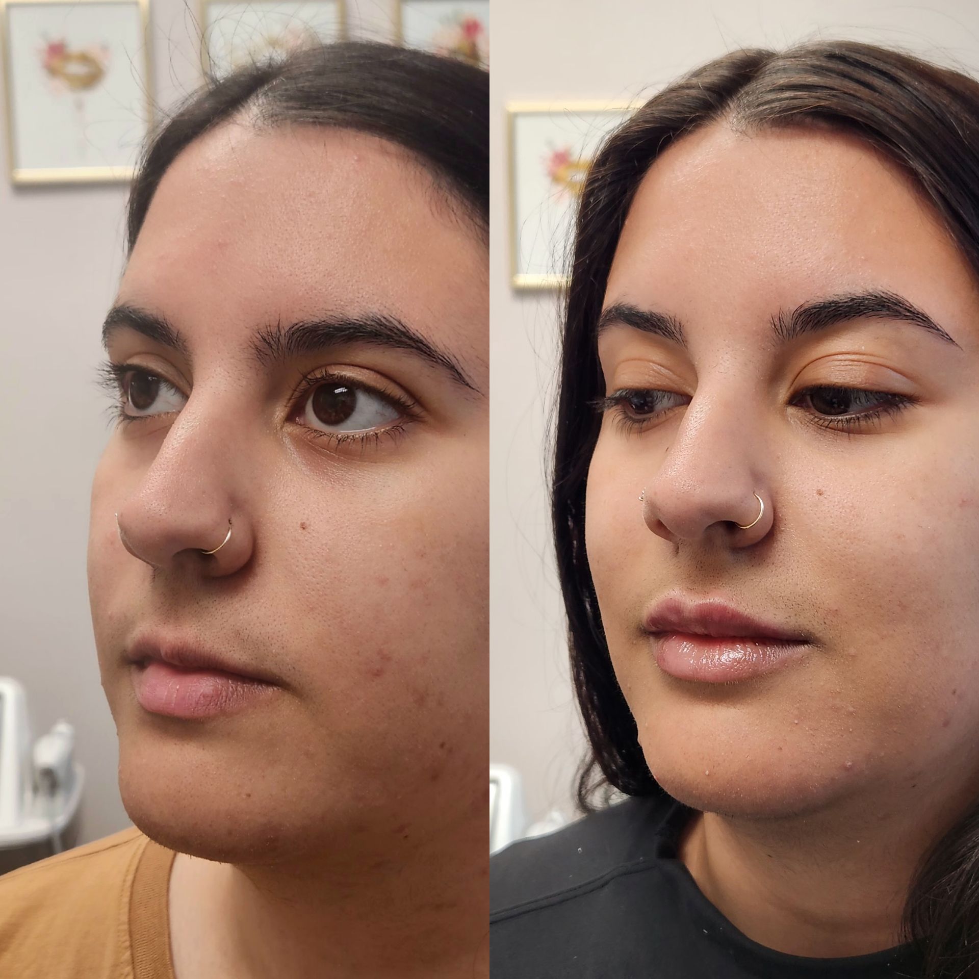 A before and after photo of a woman 's face