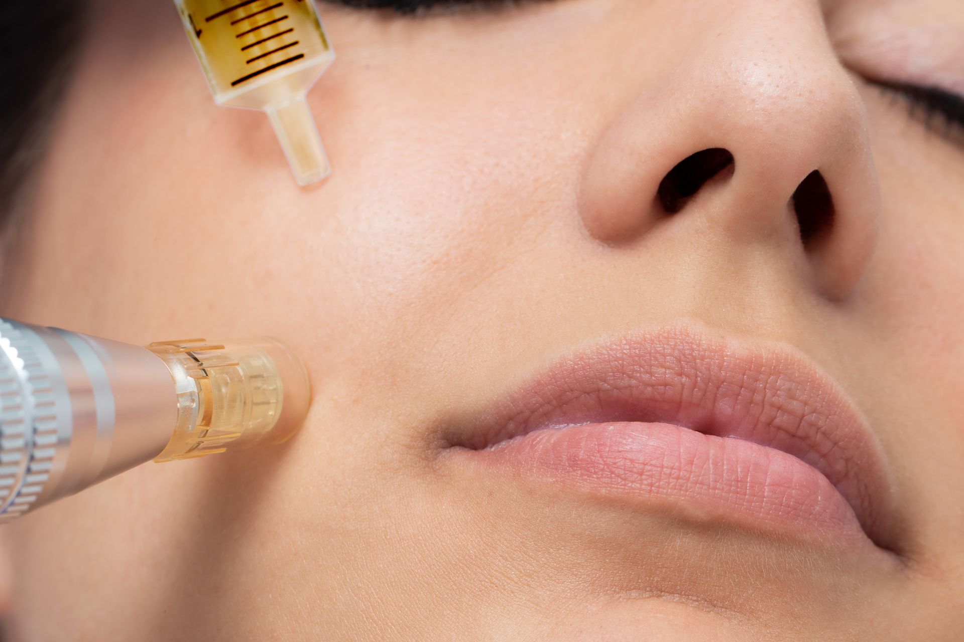 A woman is getting a facial treatment with a syringe.