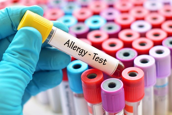 Allergy Test Sample