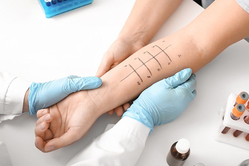 Person Undergoing Allergen Skin Test