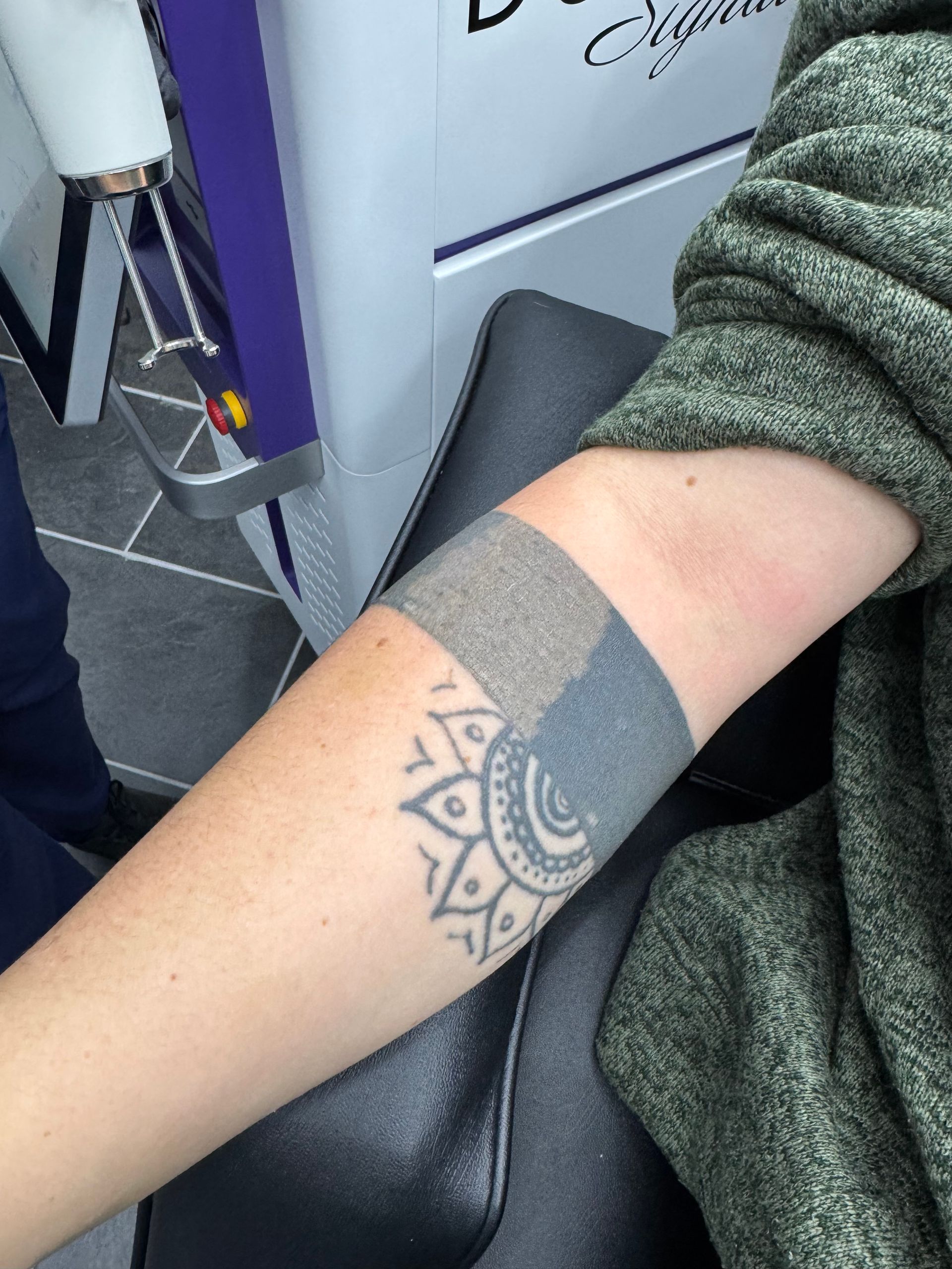 A person has a tattoo of a clown on their arm