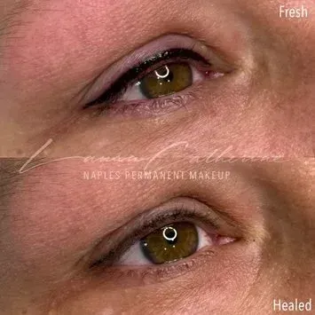Comparison of eyeliner permanent makeup, fresh (top) and healed (bottom).
