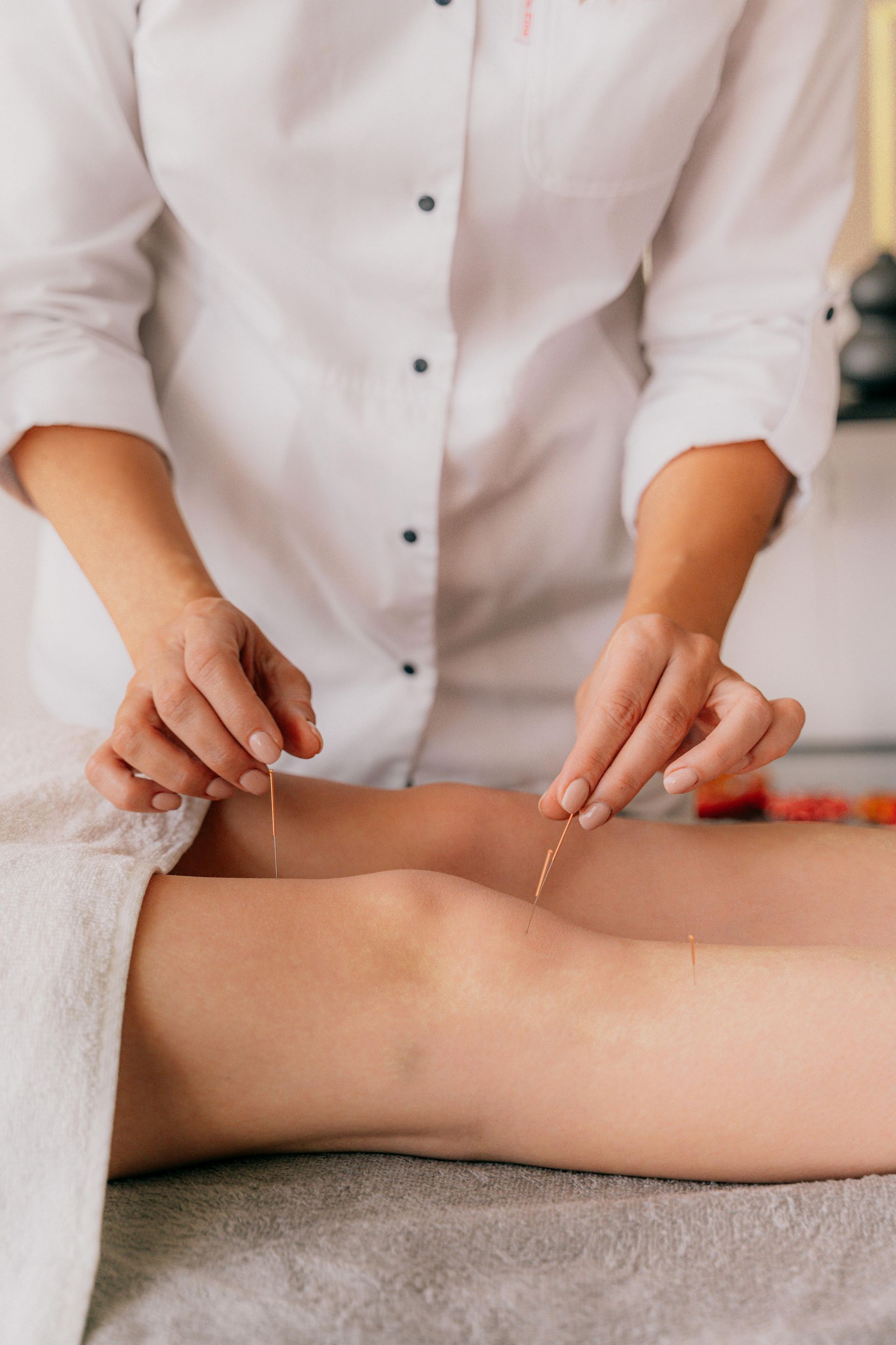 A person performing acupuncture on a patient's leg; close-up of hands and needles near the knee.