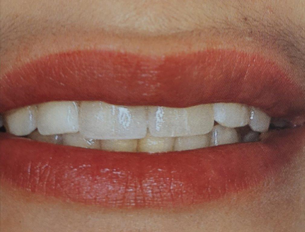 Primo piano della bocca sorridente di una persona, che mostra i denti bianchi e le labbra rosse.