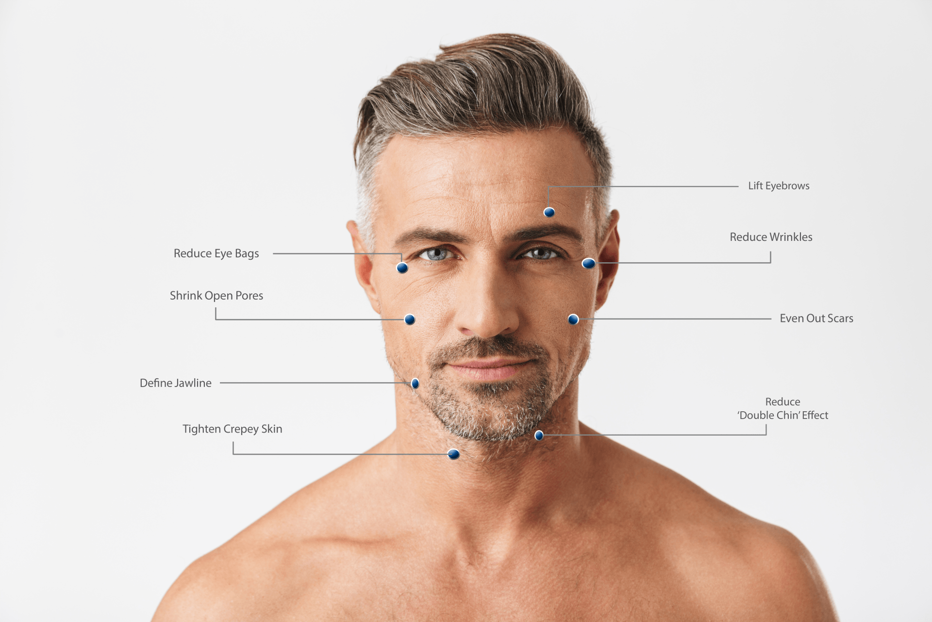 Middle age Man Head and Shoulders with pointers to facial ares