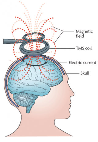 Sample illustration of transcranial magnetic stimulation