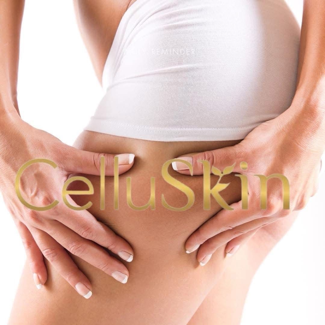 Femme se pinçant la cuisse, montrant probablement de la cellulite ; logo du produit « CelluSkin » superposé.
