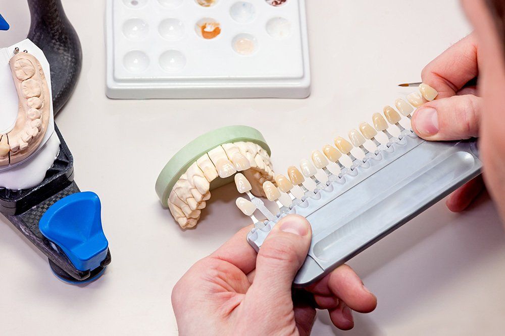 realizzazione di un impianto dentale