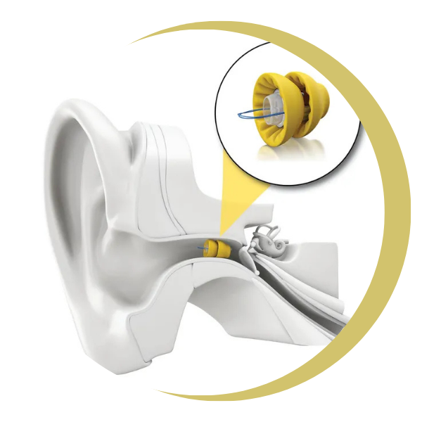 A close up of an ear with a pair of yellow ear plugs