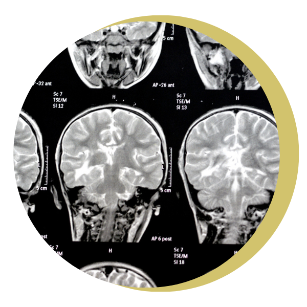 A black and white image of a brain in a circle