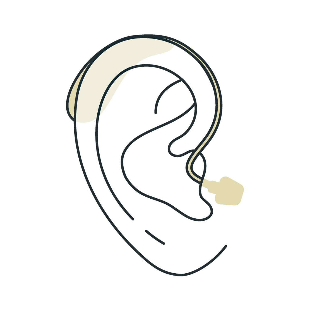 Ear with a hearing aid, beige and black outline.