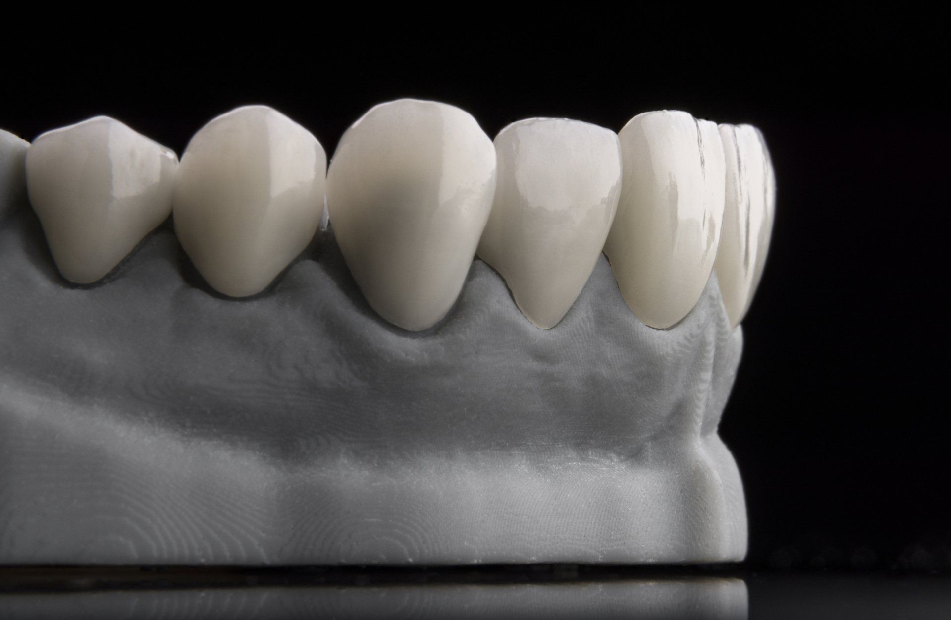 Ceramic dental veneers on artificial plastic jaw — Madison, WI — East Grove Dental