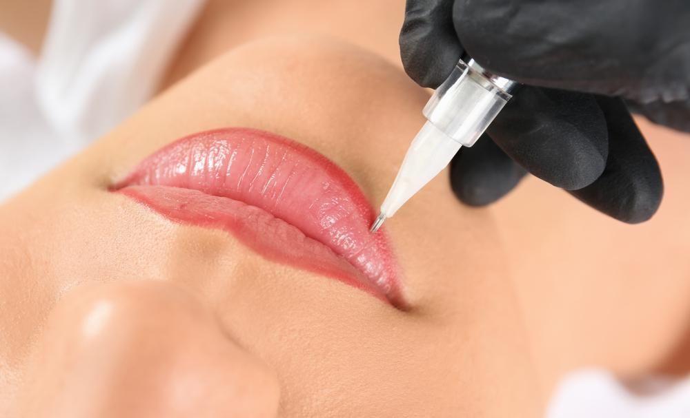 A Woman Is Getting A Permanent Lip Tattoo On Her Lips — Mackay Skin Clinic In North Mackay, QLD
