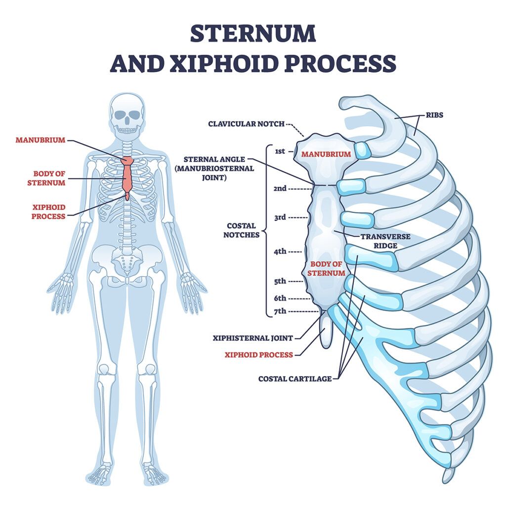 Diagram showing human sternum and xiphoid process, with skeletal and ribcage views.