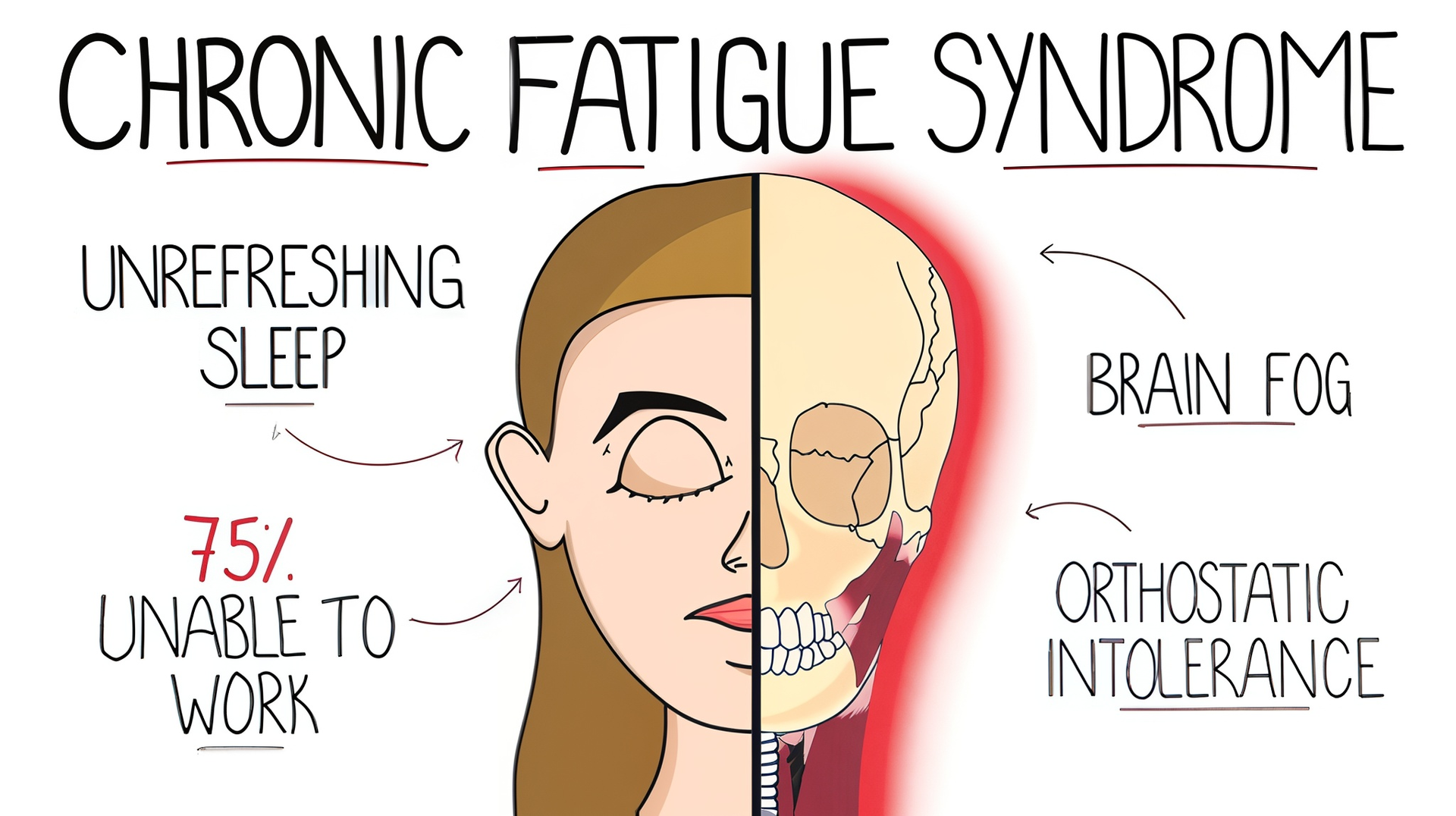 Illustration of a person with half of their face and skull exposed. Text describes chronic fatigue symptoms.
