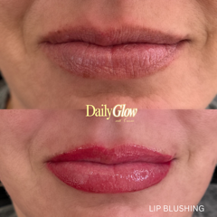 Comparison of lips before and after lip blushing. Top: dull pink. Bottom: bright red-pink, glossy.