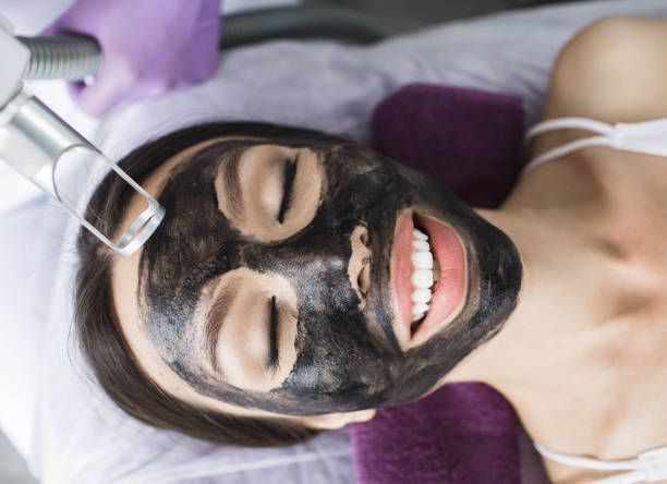 Radiofrequenz Microneedling