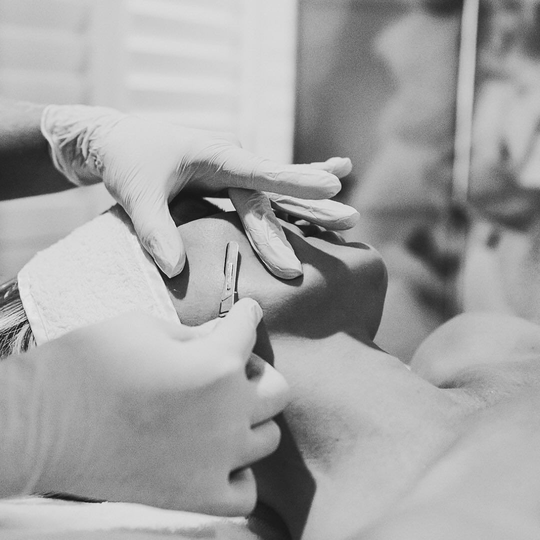Hands in gloves performing a medical procedure on a person's face; black and white.