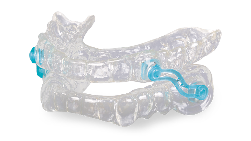 A close up of a clear Mandibular Advancement Device on a white background.