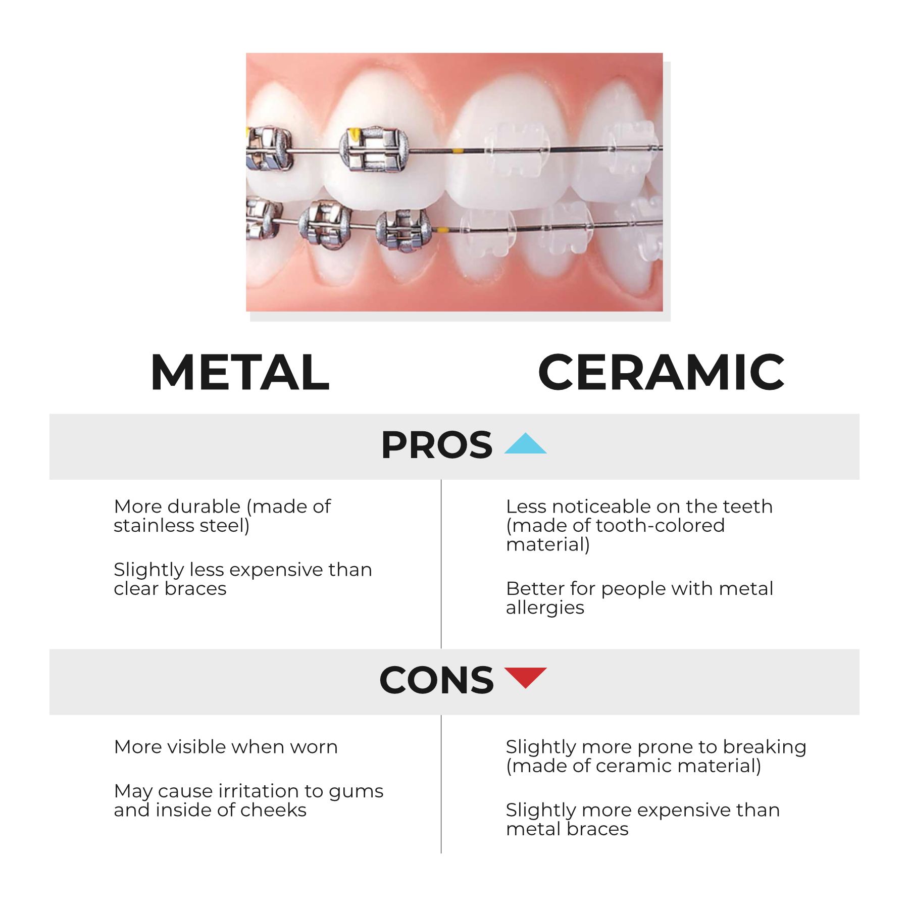 Metal vs Ceramic Braces Infographic