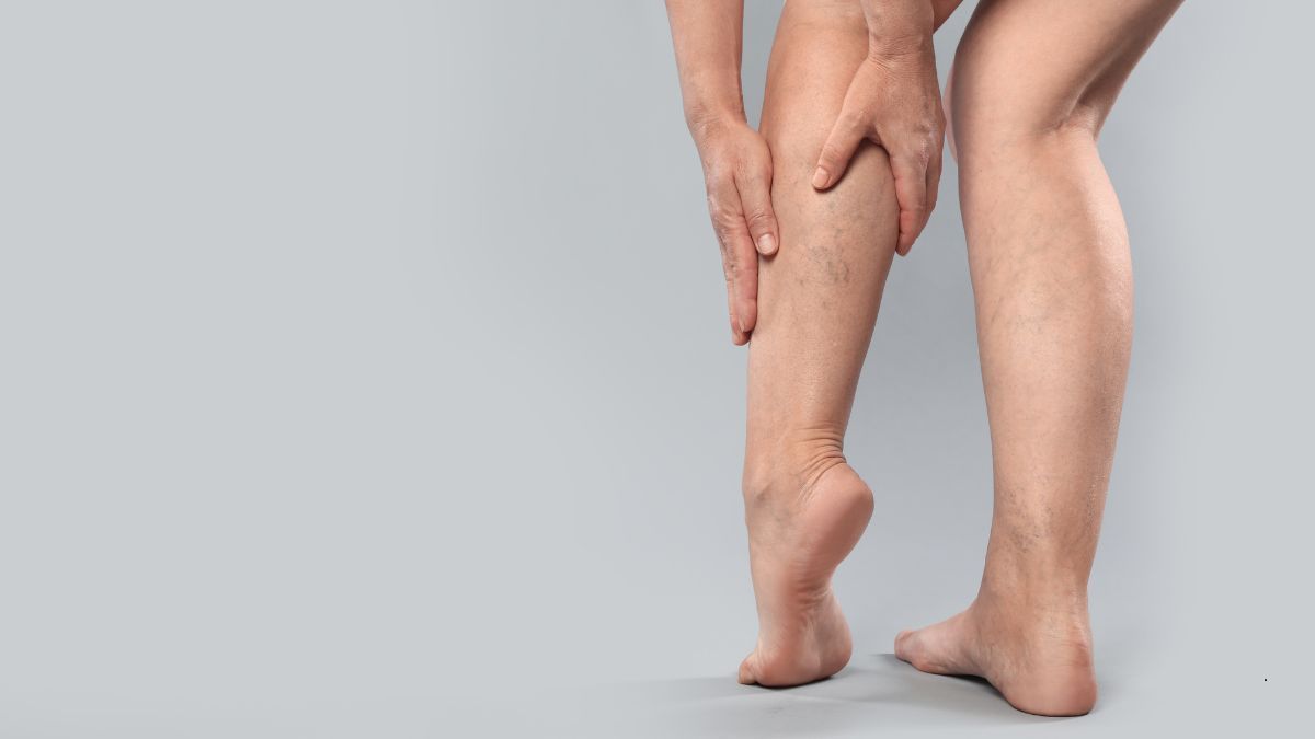 Diagnosi Vascolare Non Invasiva