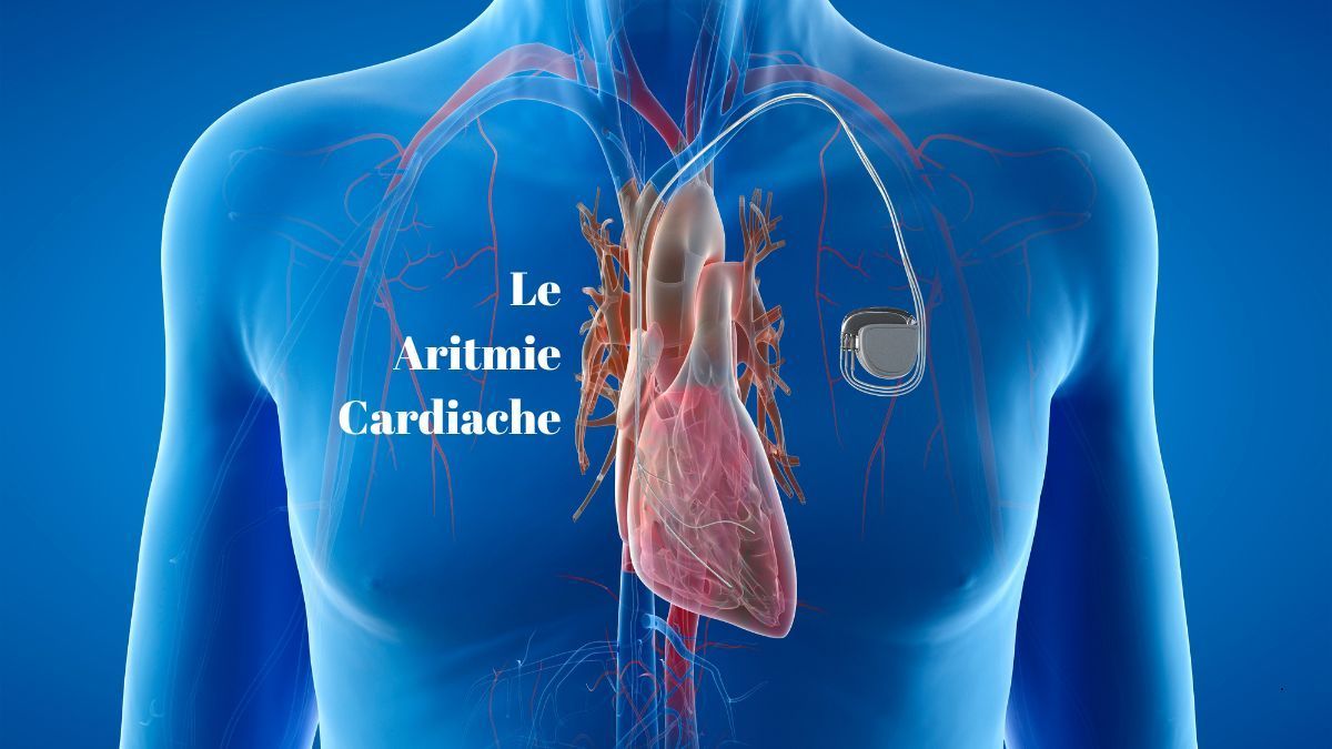 La Aritmie Cardiache | Poliambulatorio IGEA Piacenza