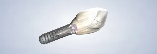 A close up of a dental implant with a tooth in it.