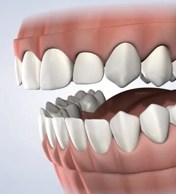 Pre-Prosthetic Surgery