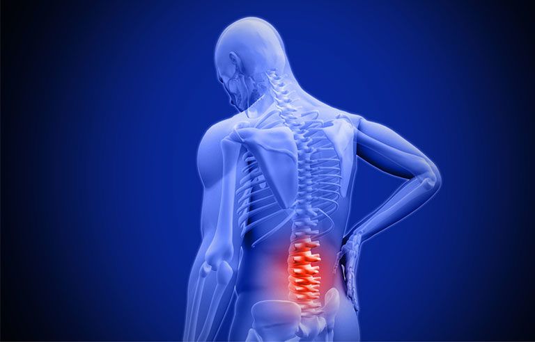 A man is holding his back in pain because of a backache.