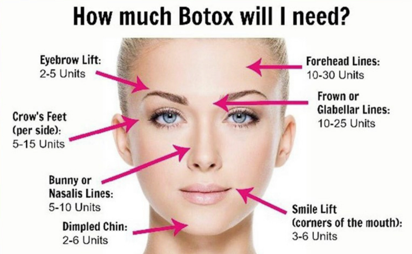Botox Infographic — Bryant, AR — Practical Wellness Clinic