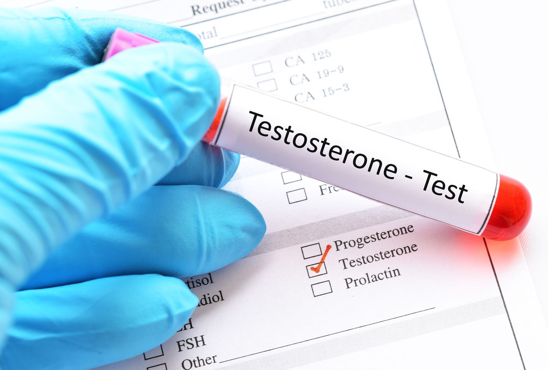 Gloved hand holding a testosterone test tube next to a lab form; shows checked box next to 