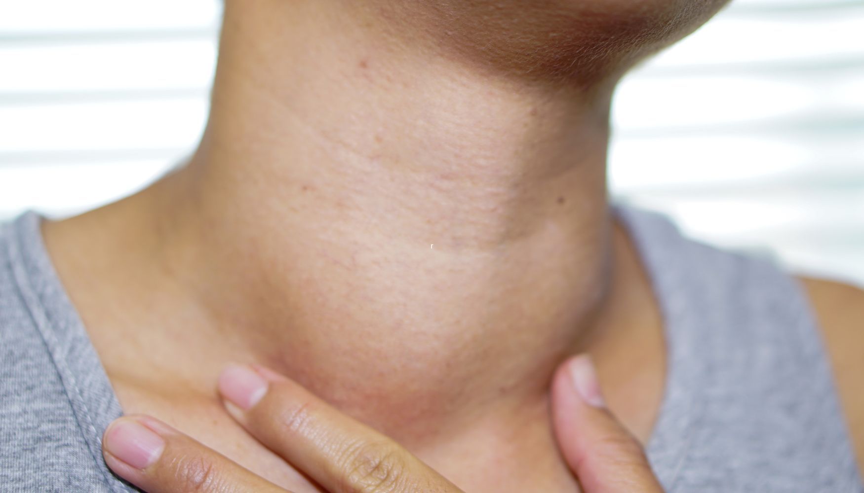 can stress cause hyperthyroidism
