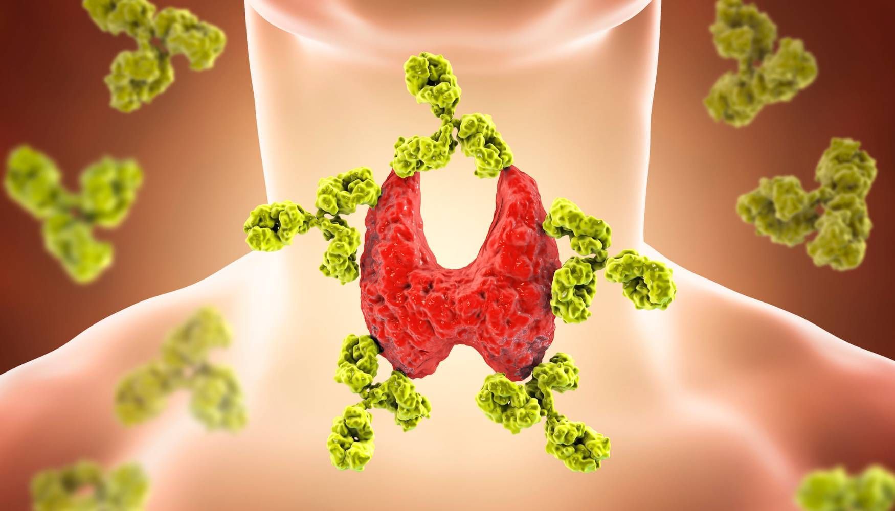 inflammation and hypothyroidism