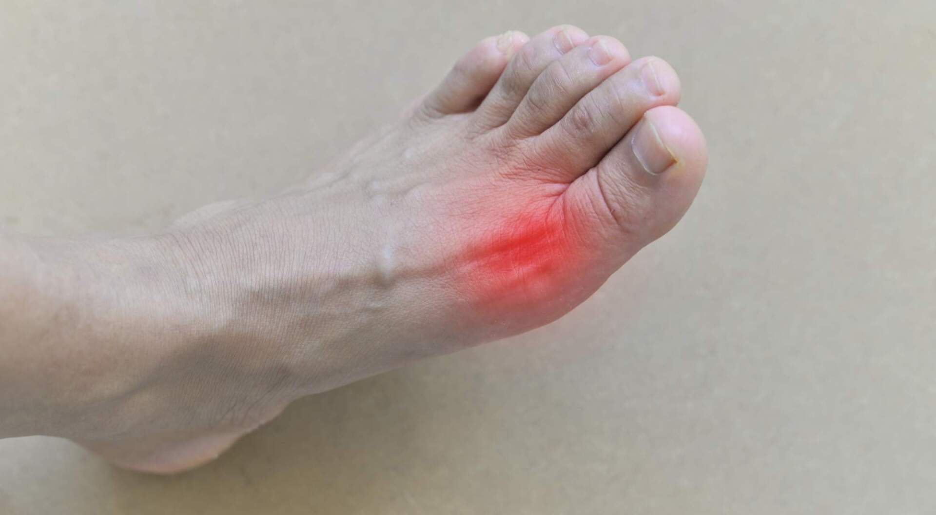 list of foods to avoid with gout