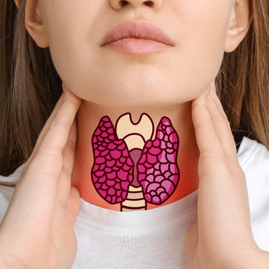 Thyroid visual data 5