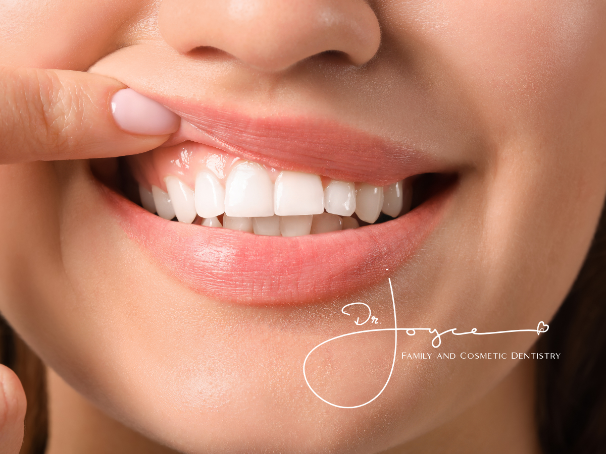 The Science Behind Teeth Whitening: Why Westwood Residents are Choosing Professional Care