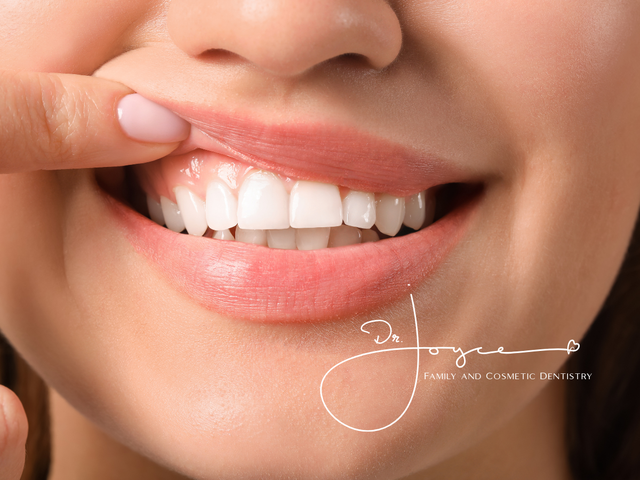 Dental Patients | Dr. Joyce Dentistry | West LA Dentist