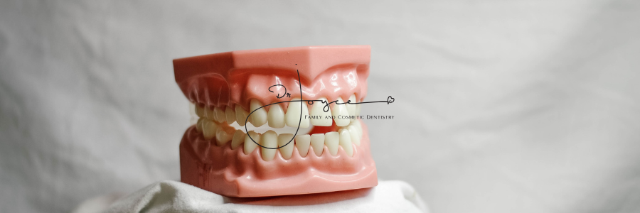 A row of teeth with different shades of white on a table.
