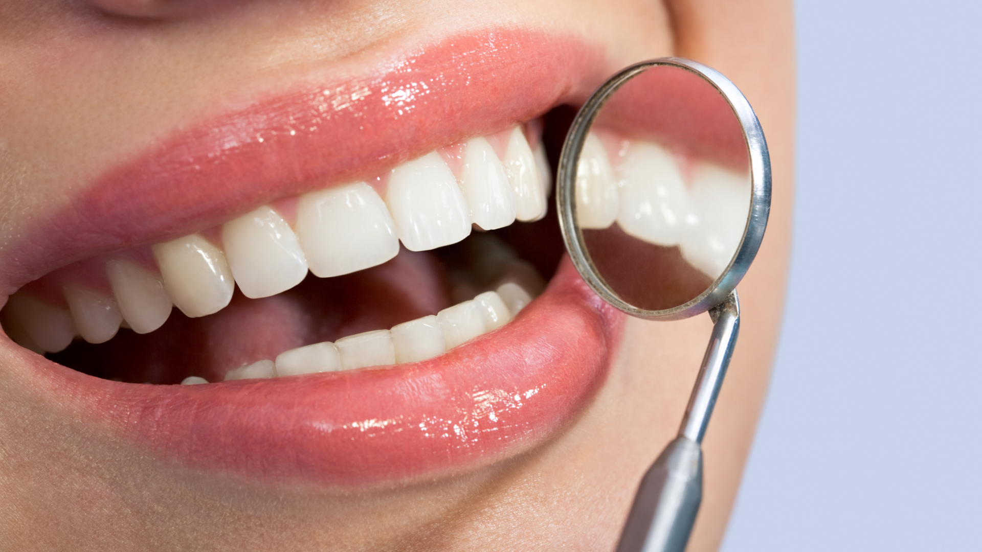 A close-up view of a person’s teeth and smile while a dentist's mouth mirror reflects the back of their upper teeth.